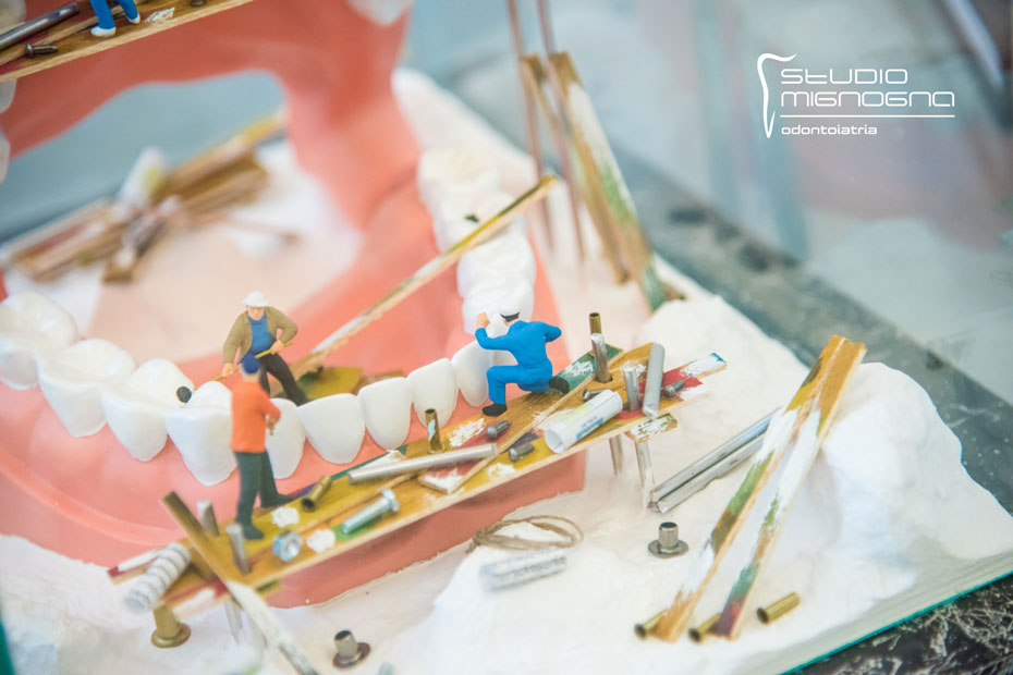 dentista napoli studio mignogna Pulizia denti