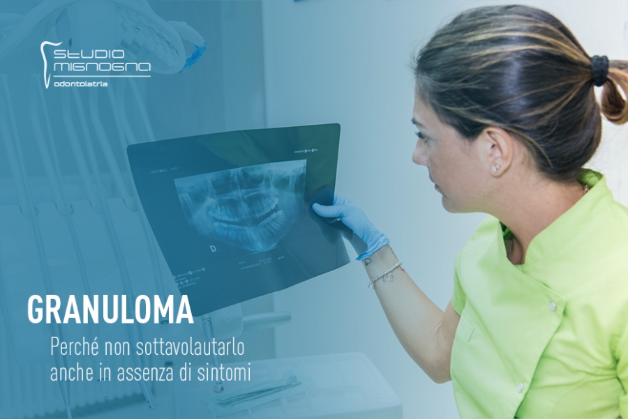 Studio Odontoiatrico Mignogna - Granuloma dentale