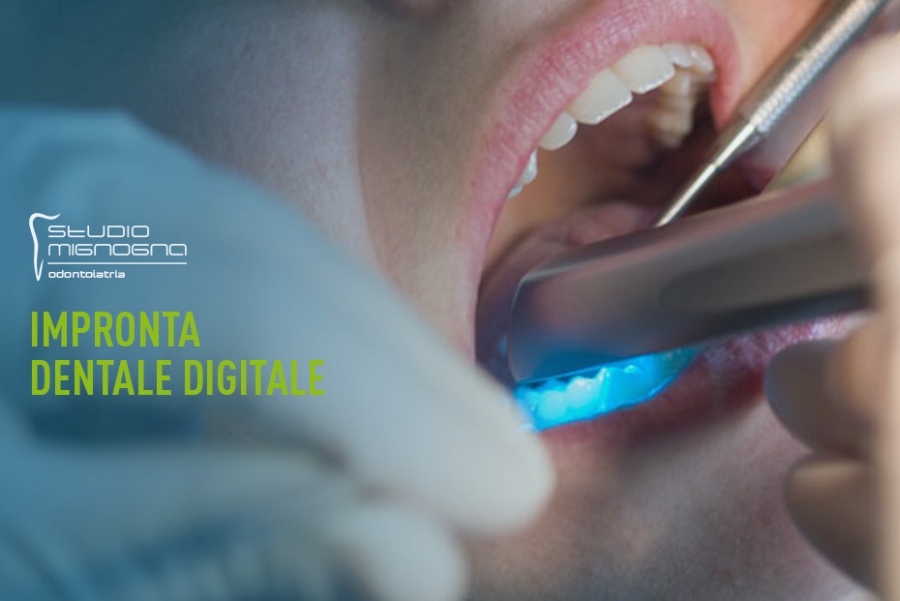 Studio Odontoiatrico Mignogna - I vantaggi dell’ impronta dentale digitale