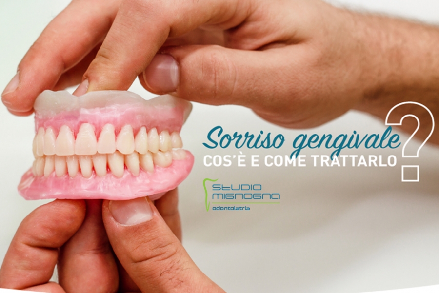 Studio Odontoiatrico Mignogna - Come si corregge il sorriso gengivale?